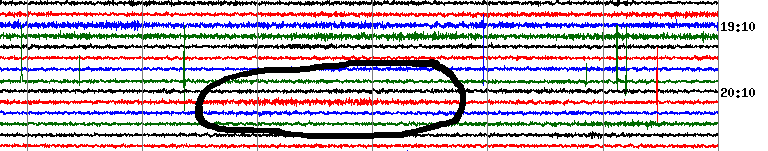 Webicorder excerpt